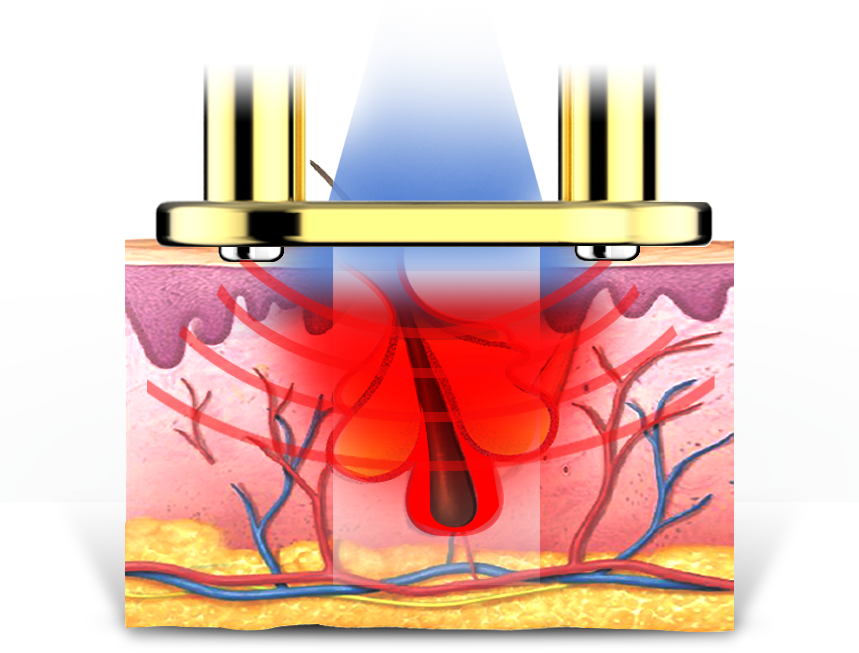 Maximum Thermal Energy