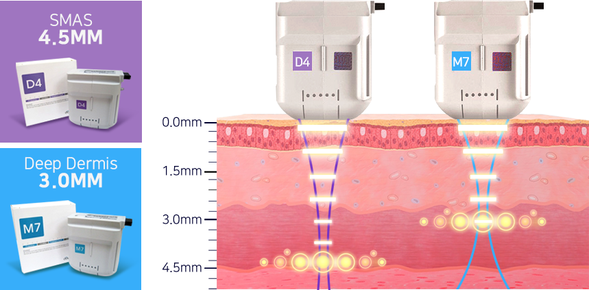 Optimized cartridges for specific area