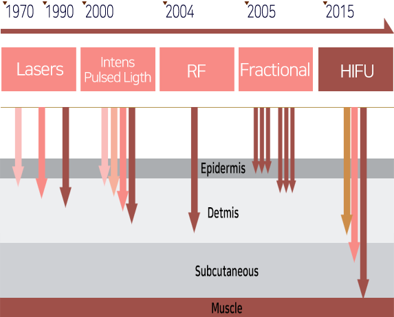 technology trend hironic