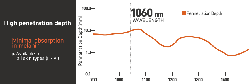 1060nm Wavelength Laser