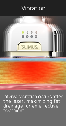 How SLIMUS Works